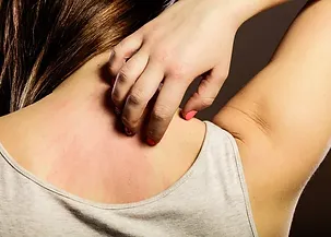 Dermatitis
