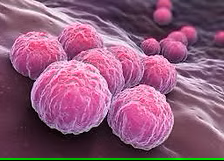 Chlamydia